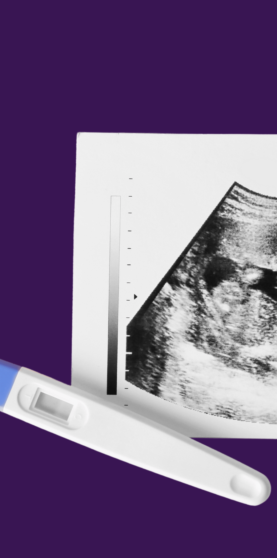 Pregnancy-Journey-