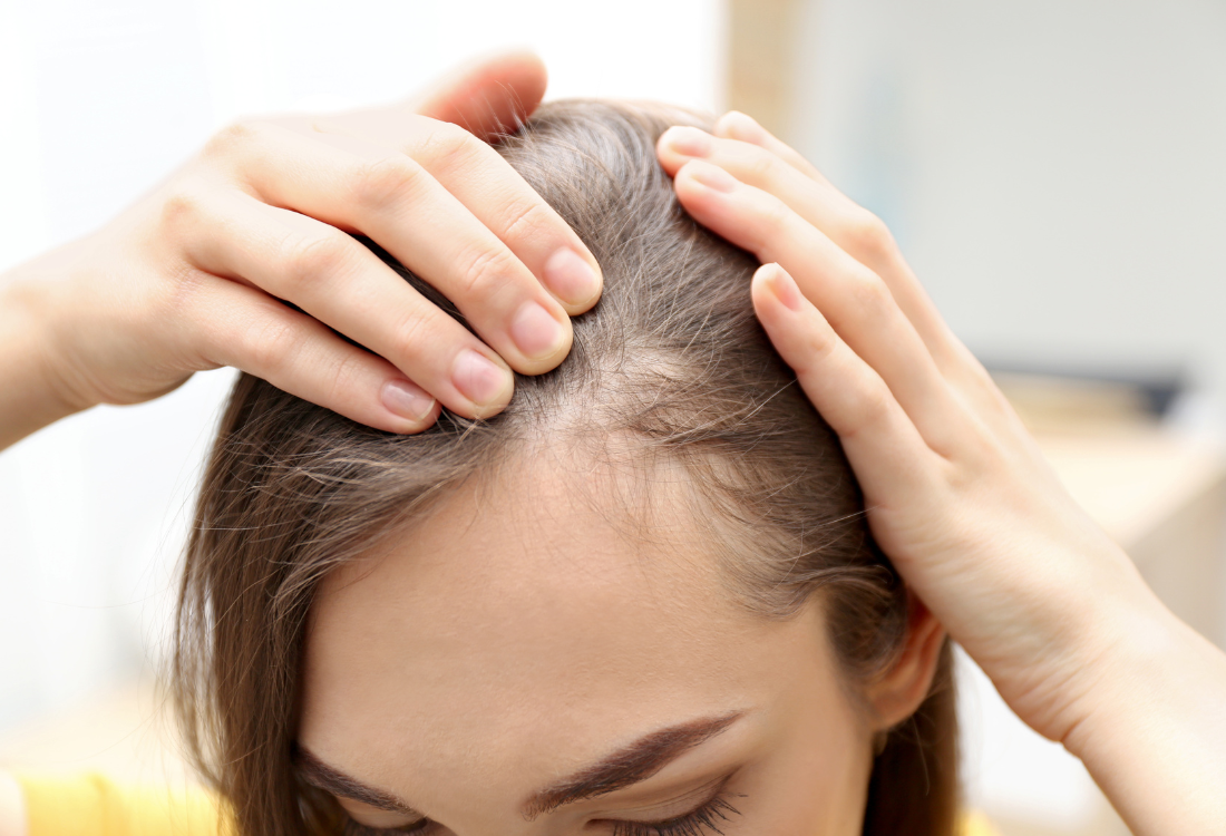 How a lack of vitamin D can cause hair loss